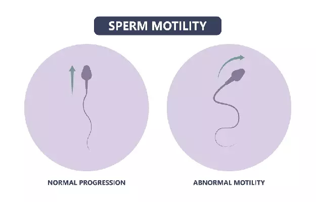 sperm