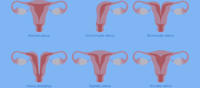 uterine-abnormalities-2048x901